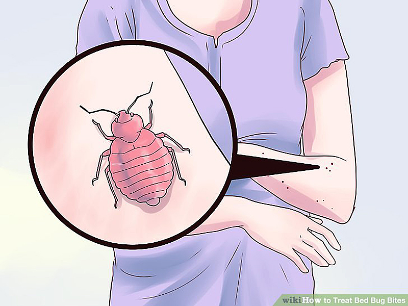 Insect bites & infections Treatment